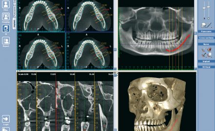 Radiologia Odontoiatrica